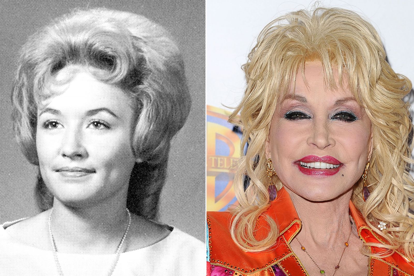 Dolly Parton Picture | Before They Were Famous - ABC News