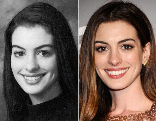 Academy Awards co-host Anne Hathaway had the same trademark smile in her