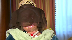 oprah winfrey woman attacked by chimpanzee