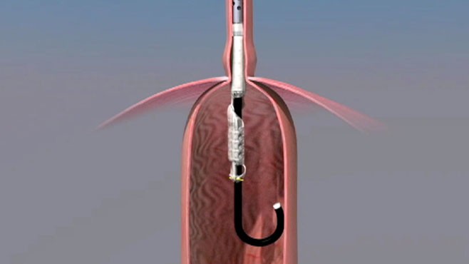 buy cheap crestor without prescription buy cheap crestor without prescription