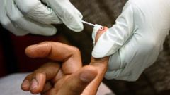 As Many as 4 in 10 Gay Men Have HIV in Some Southern Cities 