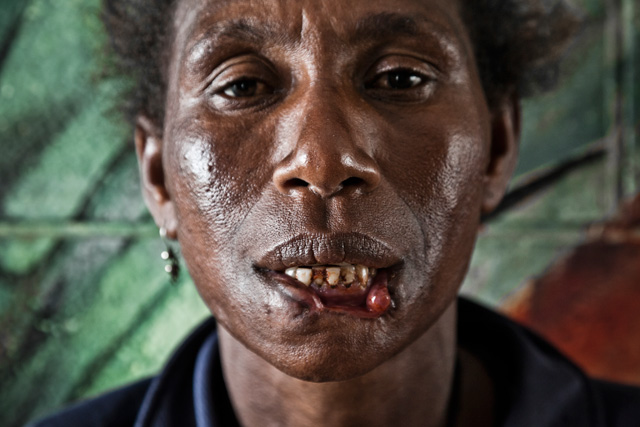 crying meri 007 dm 1 blog Crying Meri: Violence Against Women in Papua New Guinea 