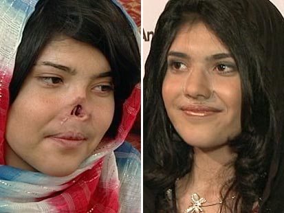 Bibi+aisha+afghanistan