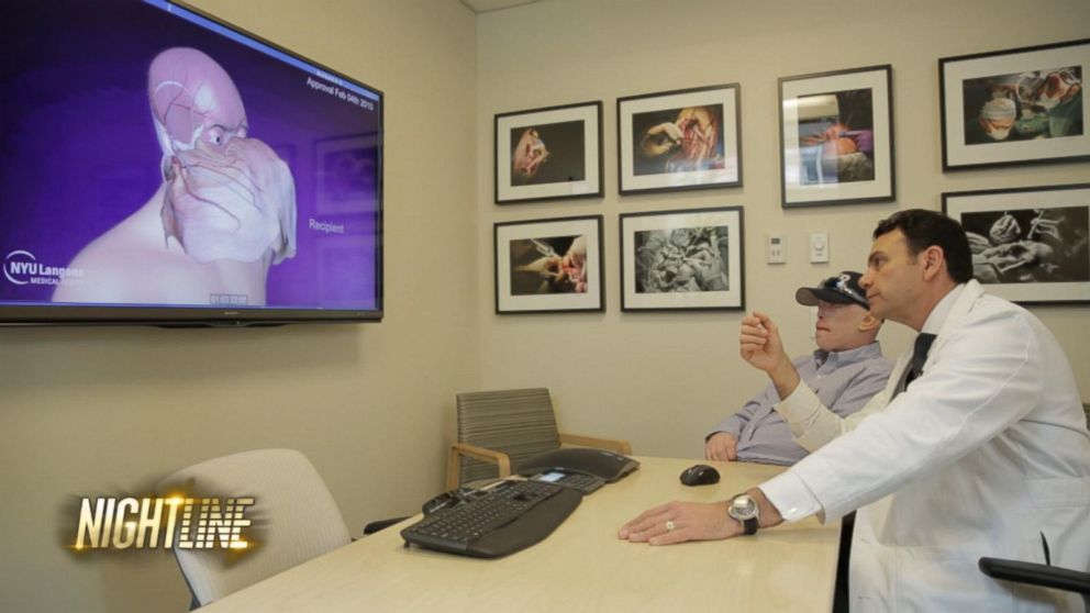 VIDEO: Face Transplant Surgery Explained Step-By-Step