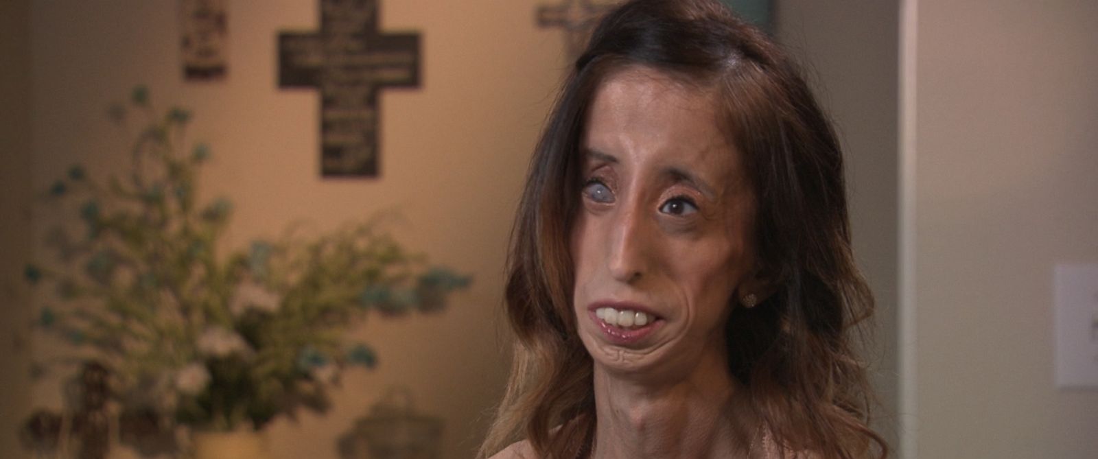 Lizzie Velasquez on Choosing to Fight Bullies: 'I Wanted To Have ...